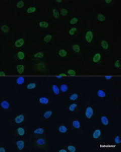 Immunofluorescence analysis of U-2 OS cells using GTF2E1 Polyclonal Antibody at dilution of 1:100 (40x lens) . Blue: DAPI for nuclear staining.