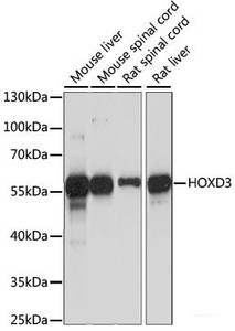 Western blot analysis of extracts of various cell lines using HOXD3 Polyclonal Antibody at dilution of 1:1000.