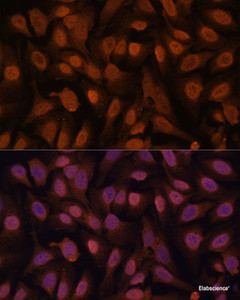 Immunofluorescence analysis of U-2 OS cells using ZNF131 Polyclonal Antibody at dilution of 1:100. Blue: DAPI for nuclear staining.