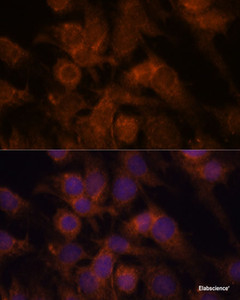 Immunofluorescence analysis of C6 cells using SEC23IP Polyclonal Antibody at dilution of 1:100. Blue: DAPI for nuclear staining.