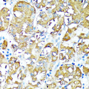 Immunohistochemistry of paraffin-embedded Human stomach using TNFR1 Polyclonal Antibody at dilution of 1:100 (40x lens) .