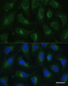 Immunofluorescence analysis of U-2 OS cells using SULT1C4 Polyclonal Antibody at dilution of 1:100. Blue: DAPI for nuclear staining.