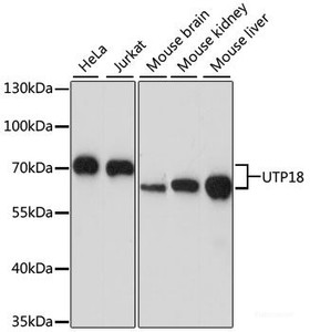 Western blot analysis of extracts of various cell lines using UTP18 Polyclonal Antibody at dilution of 1:1000.