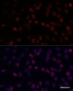 Immunofluorescence analysis of C6 cells using DDX24 Polyclonal Antibody at dilution of 1:100. Blue: DAPI for nuclear staining.