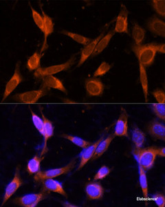 Immunofluorescence analysis of NIH-3T3 cells using VMP1 Polyclonal Antibody at dilution of 1:100 (40x lens) . Blue: DAPI for nuclear staining.