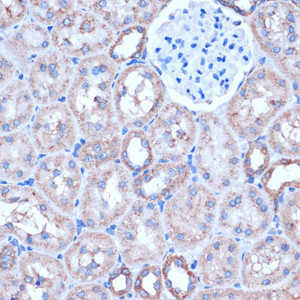 Immunohistochemistry of paraffin-embedded Rat kidney using ITCH Polyclonal Antibody at dilution of 1:50 (40x lens) .