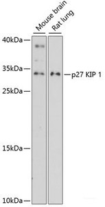 Western blot analysis of extracts of various cell lines using p27 KIP 1 Polyclonal Antibody at dilution of 1:3000.