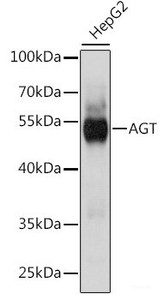 Western blot analysis of extracts of HepG2 cells using AGT Polyclonal Antibody at dilution of 1:1000.