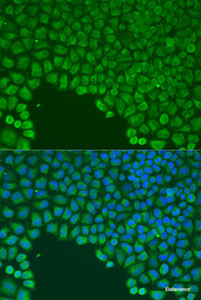 Immunofluorescence analysis of U2OS cells using CDC42 Polyclonal Antibody at dilution of 1:100. Blue: DAPI for nuclear staining.