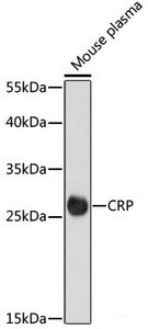 Western blot analysis of extracts of Mouse plasma using CRP Polyclonal Antibody at dilution of 1:1000.