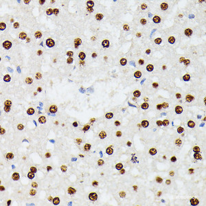 Immunohistochemistry of paraffin-embedded Rat liver using HNRNPD Polyclonal Antibody at dilution of 1:100 (40x lens) .