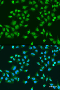 Immunofluorescence analysis of U2OS cells using RPS6KB1 Polyclonal Antibody at dilution of 1:100. Blue: DAPI for nuclear staining.