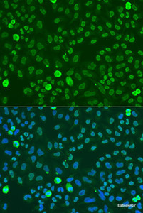 Immunofluorescence analysis of U2OS cells using SAFB Polyclonal Antibody at dilution of 1:100. Blue: DAPI for nuclear staining.