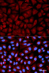 Immunofluorescence analysis of U2OS cells using SERPINC1 Polyclonal Antibody