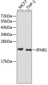 Western blot analysis of extracts of various cell lines using IFNB1 Polyclonal Antibody at dilution of 1:1000.