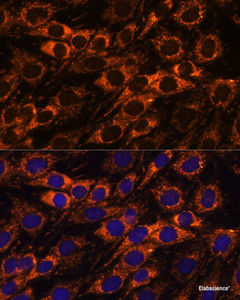 Immunofluorescence analysis of C6 cells using ACAA2 Polyclonal Antibody at dilution of 1:100. Blue: DAPI for nuclear staining.