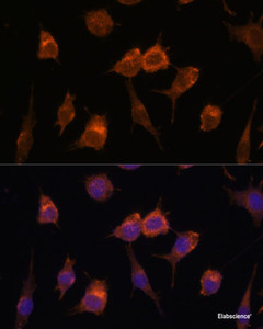 Immunofluorescence analysis of L929 cells using AVIL Polyclonal Antibody at dilution of 1:100. Blue: DAPI for nuclear staining.