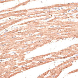 Immunohistochemistry of paraffin-embedded Rat heart using KIF1C Polyclonal Antibody at dilution of 1:100 (40x lens) .