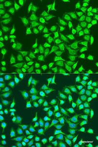 Immunofluorescence analysis of U2OS cells using SIRT4 Polyclonal Antibody at dilution of 1:100. Blue: DAPI for nuclear staining.
