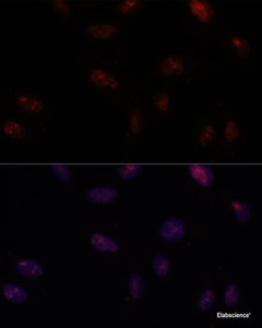 Immunofluorescence analysis of U-2 OS cells using SF3B1 Polyclonal Antibody at dilution of 1:100. Blue: DAPI for nuclear staining.