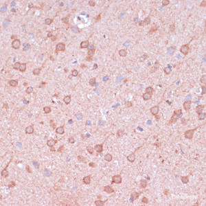 Immunohistochemistry of paraffin-embedded Rat brain using TIMM8B Polyclonal Antibody at dilution of 1:100 (40x lens) .