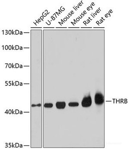 Western blot analysis of extracts of various cell lines using THRB Polyclonal Antibody at dilution of 1:1000.