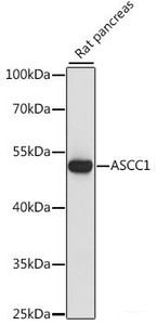 Western blot analysis of extracts of Rat pancreas using ASCC1 Polyclonal Antibody at dilution of 1:1000.