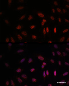 Immunofluorescence analysis of U-2 OS cells using WDR18 Polyclonal Antibody at dilution of 1:100. Blue: DAPI for nuclear staining.