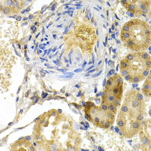 Immunohistochemistry of paraffin-embedded Rat kidney using BAD Polyclonal Antibody at dilution of 1:200 (40x lens) .