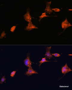 Immunofluorescence analysis of C6 cells using TSC2 Polyclonal Antibody at dilution of 1:100. Blue: DAPI for nuclear staining.