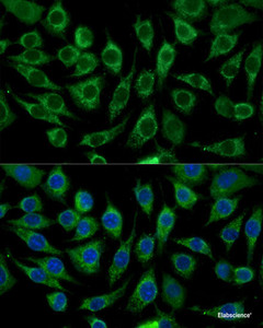 Immunofluorescence analysis of L929 cells using ABCD2 Polyclonal Antibody at dilution of 1:100 (40x lens) . Blue: DAPI for nuclear staining.