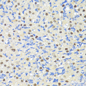 Immunohistochemistry of paraffin-embedded Rat ovary using TRIM27 Polyclonal Antibody at dilution of 1:100 (40x lens) .