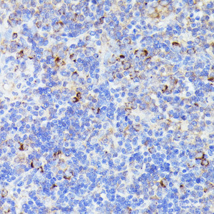 Immunohistochemistry of paraffin-embedded Rat lymph node using CCDC6 Polyclonal Antibody at dilution of 1:100 (40x lens) .