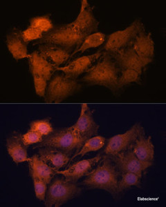 Immunofluorescence analysis of C6 cells using SYCP2 Polyclonal Antibody at dilution of 1:100. Blue: DAPI for nuclear staining.