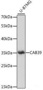 Western blot analysis of extracts of U-87MG cells using CAB39 Polyclonal Antibody at dilution of 1:1000.