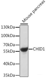 Western blot analysis of extracts of Mouse pancreas using CHID1 Polyclonal Antibody at dilution of 1:1000.