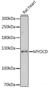 Western blot analysis of extracts of Rat heart using MYOCD Polyclonal Antibody at dilution of 1:1000.