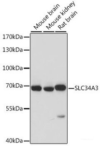 Western blot analysis of extracts of various cell lines using SLC34A3 Polyclonal Antibody at dilution of 1:1000.