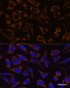 Immunofluorescence analysis of L929 cells using GTPBP8 Polyclonal Antibody at dilution of 1:100. Blue: DAPI for nuclear staining.