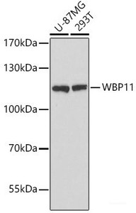 Western blot analysis of extracts of various cell lines using WBP11 Polyclonal Antibody at dilution of 1:3000.