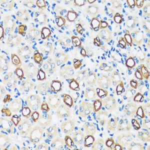 Immunohistochemistry of paraffin-embedded Mouse kidney using AQP2 Polyclonal Antibody at dilution of 1:100 (40x lens) .