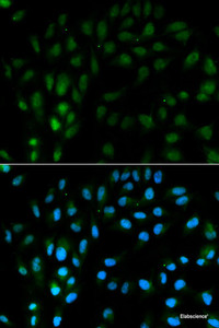 Immunofluorescence analysis of MCF-7 cells using TFPI Polyclonal Antibody