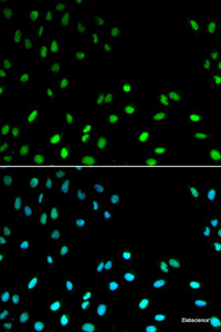 Immunofluorescence analysis of MCF-7 cells using RFC1 Polyclonal Antibody