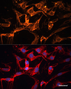 Immunofluorescence analysis of C6 cells using LPL Polyclonal Antibody at dilution of 1:100. Blue: DAPI for nuclear staining.