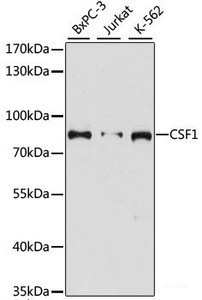 Western blot analysis of extracts of various cell lines using CSF1 Polyclonal Antibody at dilution of 1:3000.