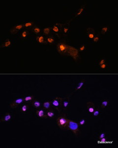 Immunofluorescence analysis of A431 cells using KLF8 Polyclonal Antibody at dilution of 1:100. Blue: DAPI for nuclear staining.