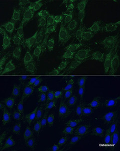 Immunofluorescence analysis of C6 cells using AEBP1 Polyclonal Antibody at dilution of 1:100 (40x lens) . Blue: DAPI for nuclear staining.
