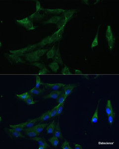 Immunofluorescence analysis of C6 cells using ARL3 Polyclonal Antibody at dilution of 1:100 (40x lens) . Blue: DAPI for nuclear staining.