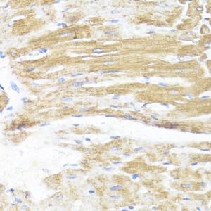 Immunohistochemistry of paraffin-embedded Rat heart using ASMT Polyclonal Antibody at dilution of 1:100 (40x lens) .