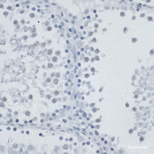 Immunohistochemistry of paraffin-embedded Rat testis using MSH6 Polyclonal Antibody at dilution of 1:100 (40x lens) .